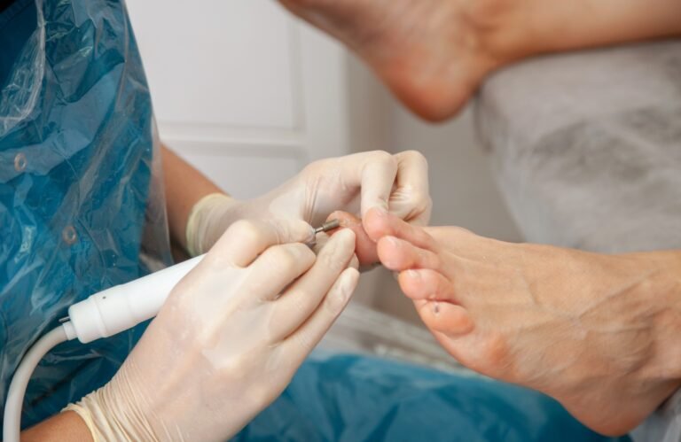 Peeling pieds lovaskin