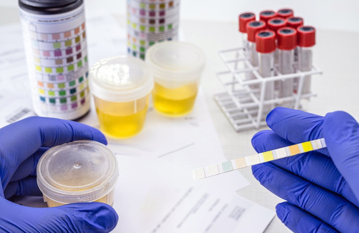 Sang dans les urines 