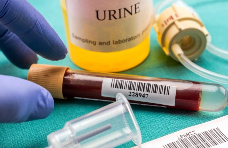 Sang dans les urines